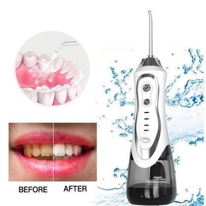 AquaPulse Portable Oral Irrigator – High-Frequency Water Flosser with 300 ml Tank